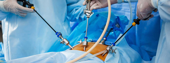 Laparoscopia Ospedale di Lucca